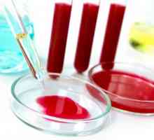 Cum să luați un test de sânge pentru Giardia