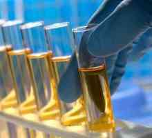 Cum să luați și care identifică analiza chimică-toxicologică a urinei?