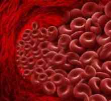 Cum de a reduce hemoglobina din sânge: dieta, medicamente și rețete tradiționale