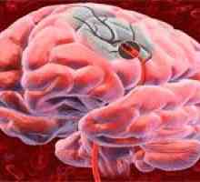 Prevenirea primară și secundară de accident vascular cerebral