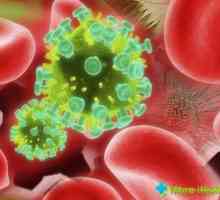 Cum de a dobândi infecția cu HIV: tot ce trebuie sa stiti despre virusul