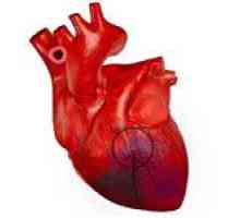 Care ar putea fi consecințele infarct miocardic extinse?