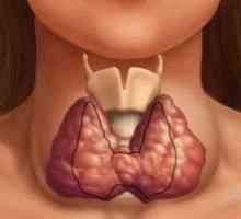Care sunt semnele reflectă dereglarea glandei tiroide