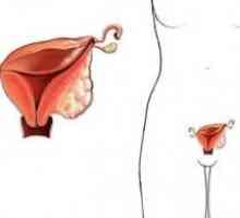 Care sunt simptomele cancerului de col uterin? Diagnosticul bolii.