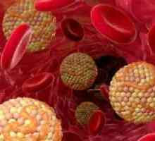 Care este rata de colesterol în sânge, și pericolul depășirii acesteia