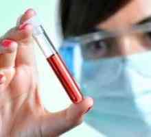Care este rata de bilirubină în sânge de copii, femei și bărbați? Analiza biochimică a sângelui.