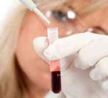 Care este rata de ESR în sângele femeilor? Indicatori cheie.