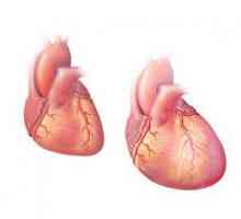 Cardiomegalie: ambele forme, simptome, diagnostic, mai ales la copii, tratament