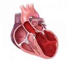 Cardiomiopatia la copii și adulți: aspectul, forma, simptome, cum de a trata