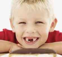 Cariile dentare si cauzele sale