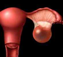 Chisturile ovariene - mai multe fațete și diverse