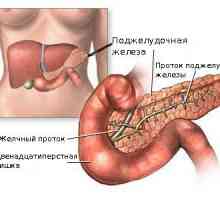 Tipuri și clasificarea pancreatită