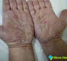 Boala pielii la oameni: cauze și tipuri