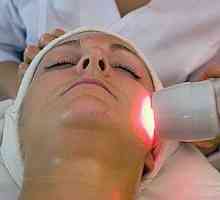 Tratament cu laser pentru acnee - o metodă modernă de a scăpa de acnee!