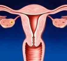 Tratamentul de remedii populare cervicita