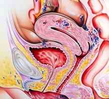 Tratamentul de remedii populare endometrioza