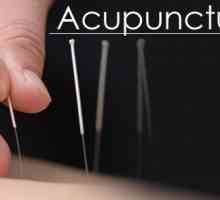 Tratamentul de acupunctura chineză