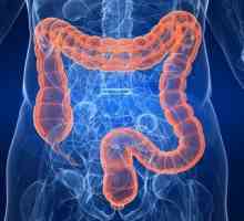 Metodele pentru tratarea intestinului iritabil sindromul remediilor populare