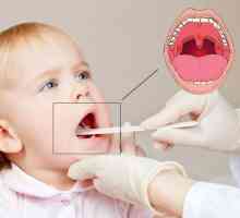 Tratamentul de amigdalită la copii