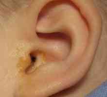 Tratamentul excreții ureche
