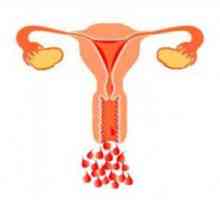 Hemoragie uterină: simptome, tratament și medicamente, motivele pe baza vârstei