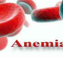 Megaloblastică (megaloblastică) anemie