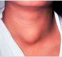 Metodele de tratament folosind remedii tiroidita populare