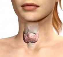 Mixedem tiroidă