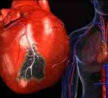 Creșterea ventriculului stâng al inimii