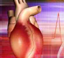 Miocardita - o inflamație a mușchiului inimii