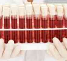 Se poate schimba grupa de sânge a unei persoane pentru viață?