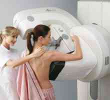 Este posibil de a face o mamografie in timpul menstruatiei?