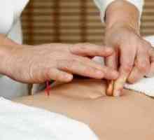 Pot folosi acupunctura în tratamentul infertilității?
