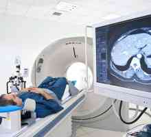 Pancreas MRI, cea mai bună metodă de diagnostic
