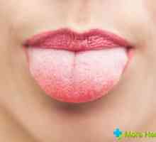 Plaque limba alb: cauze, tratamentul și prevenirea