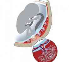 Flux afectata de sange in arterele uterine, cordon ombilical, placenta in timpul sarcinii (nmpk)