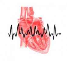 Aritmii cardiace: tipuri, cauze, simptome, tratament
