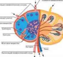 Microspherocytosis ereditar