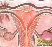 Metodele naționale actuale și valide cu apoplexie ovariană