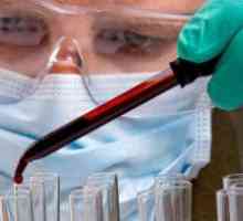 Test de sânge Numirea pentru cancerul vezicii urinare și a rezultatelor de decodare