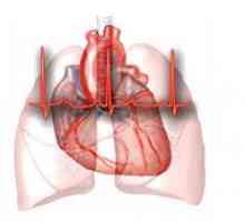 Micile anomalii de dezvoltare a inimii (Marte): adică, formele și consecințele, tratamentul