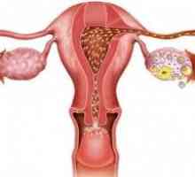 Numărul Norm de foliculi in ovare. În unele cazuri, există o abatere?