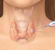 Despre biopsie tiroidian
