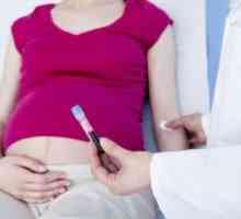 Norma fibrinogenul in timpul sarcinii si cauzeaza anomalii de proteine