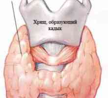 Pe nodul tiroidian coloidal