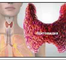 Un tiroidita autoimuna sau tiroidita Hashimoto este o glanda tiroidă