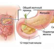 Exacerbarea inflamație a pancreasului