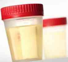 Sumar de urina unui copil: reguli de masă și interpretarea rezultatelor, caracteristicile…