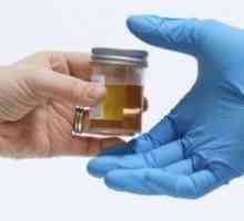 Analiza urinei: semnificație și pregătirea adecvată pentru livrarea de analiză