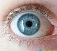 Ochii tumorale: simptome si modul de a vindeca tumora poate fi